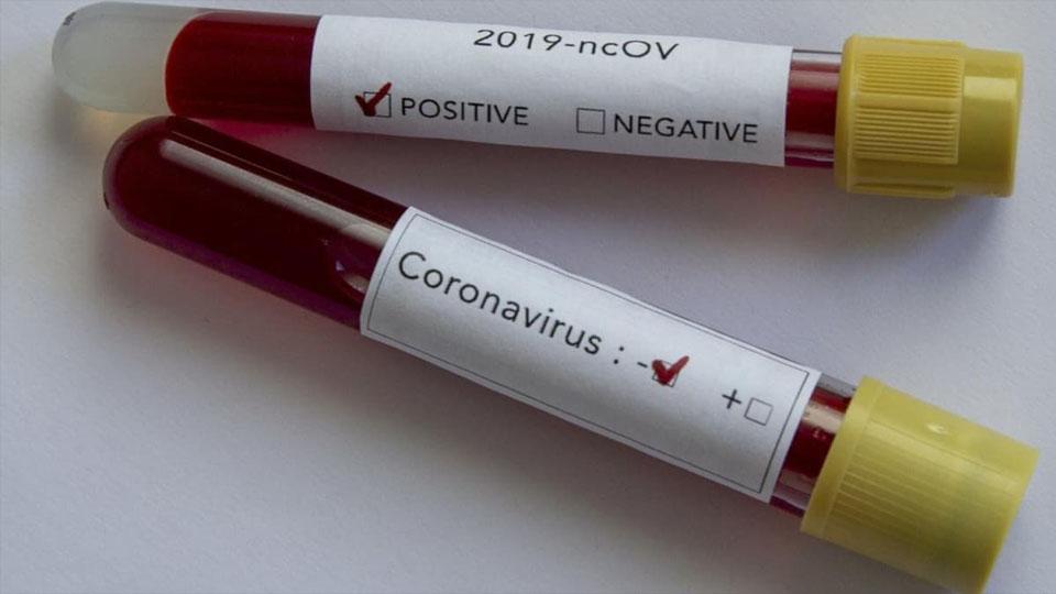 Ardahan’da koronavirüsü tedavisi gören 23 hasta  taburcu oldu