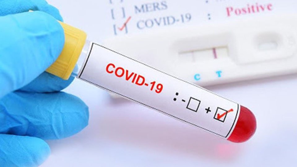 Dünya genelinde koronavirüs salgınında son durum