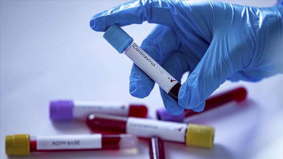 Koronavirüs Güncesi: Vaka sayısı 17 milyonu aştı