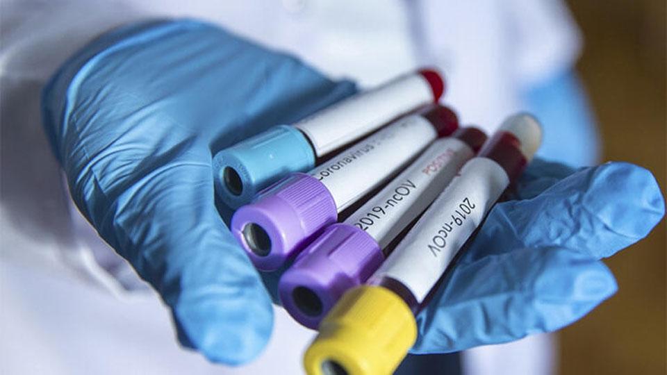 Serhatın Sesi / Serhat Diyarından Haberler / Reuters: Oxford liderliğinde geliştirilen koronavirüs aşısı insanlı denemelerde başarılı oldu!
