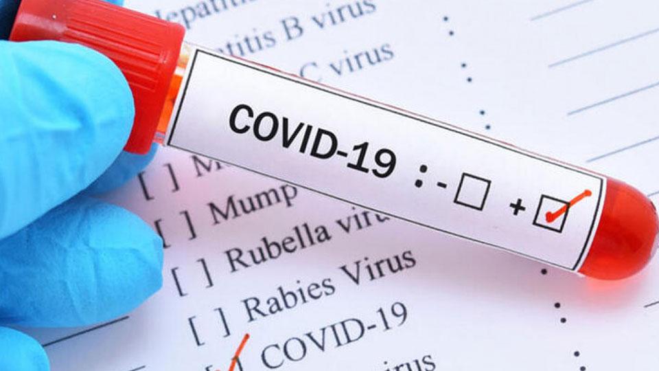 Koronavirüs Güncesi: Vaka sayısı 27 milyonu aştı